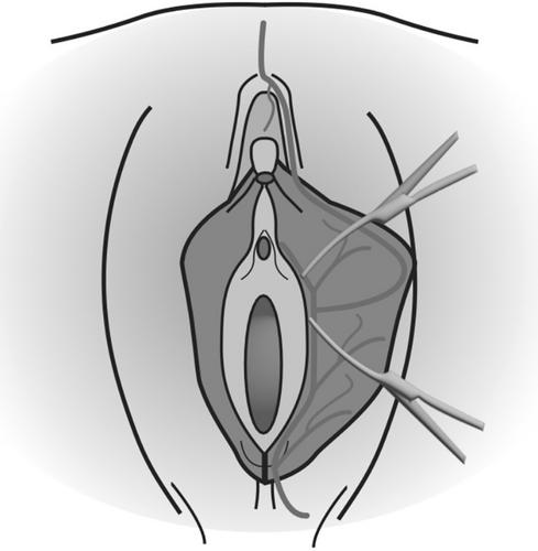 Abstract Image