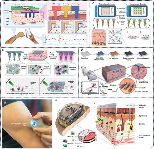 Microneedles at the Forefront of Next Generation Theranostics