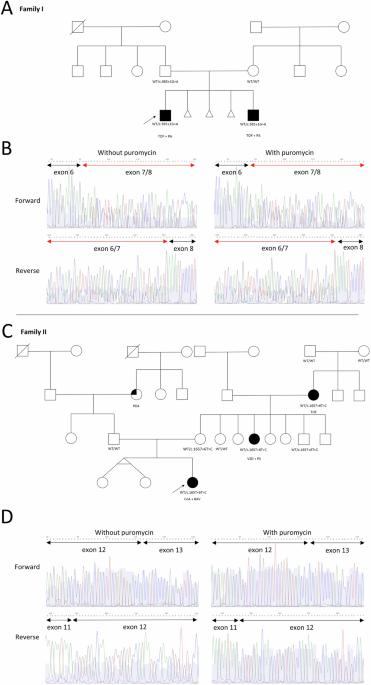RNA-sequencing unveils FLT4 splice site variants in variable congenital heart disease