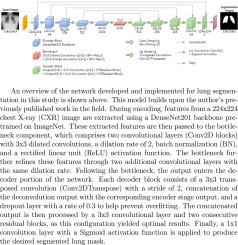 Robust lung segmentation in Chest X-ray images using modified U-Net with deeper network and residual blocks