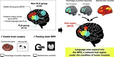 Broader functionality of language areas at the left middle frontal gyrus in patients with Broca’s area tumors