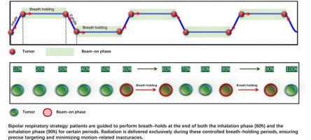 Developing and validating a bi-polar gated respiratory motion management strategy for improved lung stereotactic body radiotherapy treatment