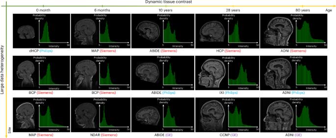 A lifespan-generalizable skull-stripping model for magnetic resonance images that leverages prior knowledge from brain atlases