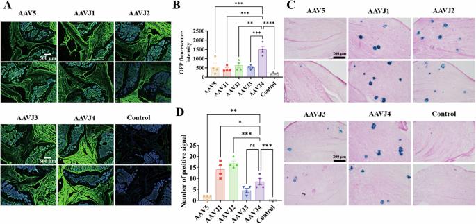 Co-delivery of IL-1Ra and SOX9 via AAV inhibits inflammation and promotes cartilage repair in surgically induced osteoarthritis animal models
