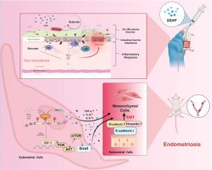 Di-(2-ethylhexyl) phthalate induces endometriosis by modulating IGF-1 m6A methylation via the intestinal Odoribacter–butyric acid axis in female rats