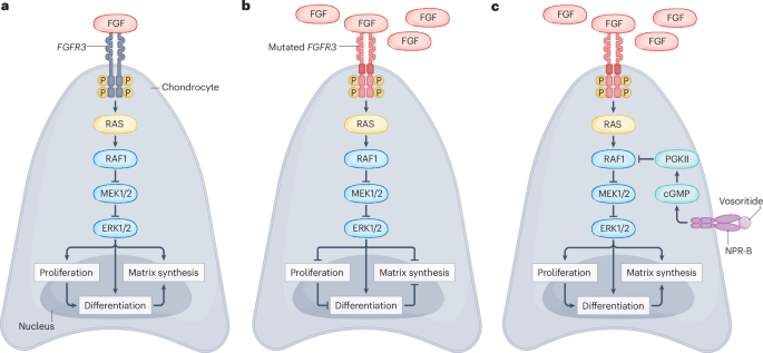 International consensus guidelines on the implementation and monitoring of vosoritide therapy in individuals with achondroplasia