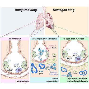 Longitudinal single-cell profiles of lung regeneration after viral infection reveal persistent injury-associated cell states