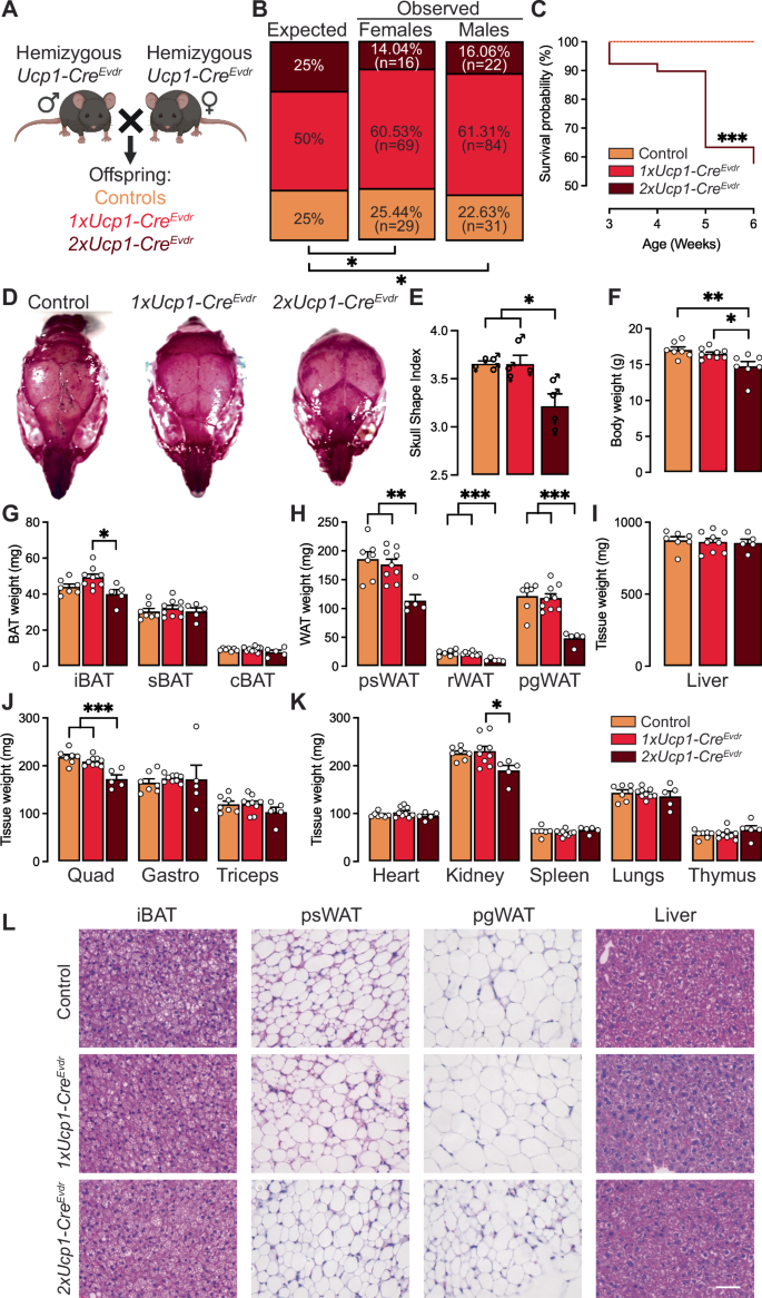 The widely used Ucp1-Cre transgene elicits complex developmental and metabolic phenotypes