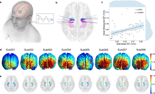 Frequency-specific and state-dependent neural responses to brain stimulation