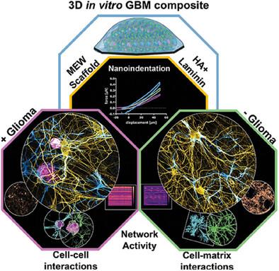 3D In Vitro Glioma-Neuron-Astrocyte Biomimetic Composites Recapitulate Key Molecular Mechanisms Linked to Glioblastoma Multiforme Pathophysiology