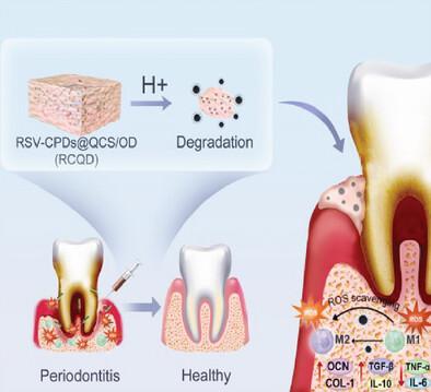 Construction of a Microenvironment-Responsive Antibacterial Hydrogel Packed With Immunomodulatory Carbonized Polymer Dots for Periodontitis Treatment From Multiple Perspectives