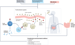 Coeliac disease: complications and comorbidities