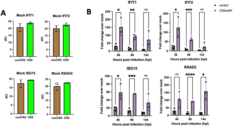 Common Cold Coronavirus 229E Induces Higher Interferon Stimulating Gene Responses in Human Nasal Epithelial Cells from Patients with Chronic Rhinosinusitis with Polyposis.