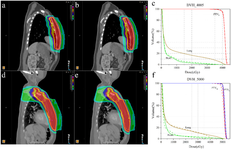 Effect of the Residual Errors on the Dose for Left-Sided Breast Cancer Radiotherapy After Translation Error Correction Based on CBCT.