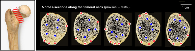 The Multifactorial Relationship Between Bone Tissue Water and Stiffness at the Proximal Femur.