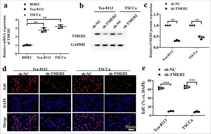 Relationship between transmembrane emp24 domain containing 2 expression and tumor stem cell characteristics in oral cancer.