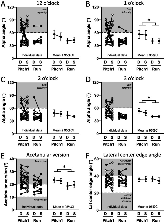 Asymptomatic female softball pitchers have altered hip morphology and cartilage composition.