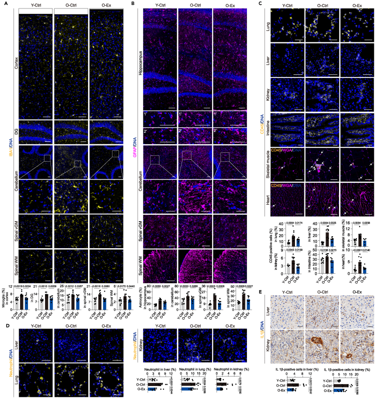 Erratum: A single-cell transcriptomic atlas of exercise-induced anti-inflammatory and geroprotective effects across the body.