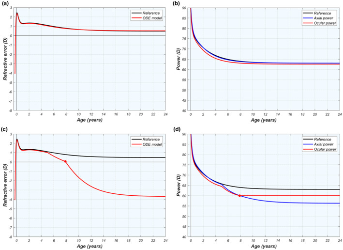 Refractive development II: Modelling normal and myopic eye growth.