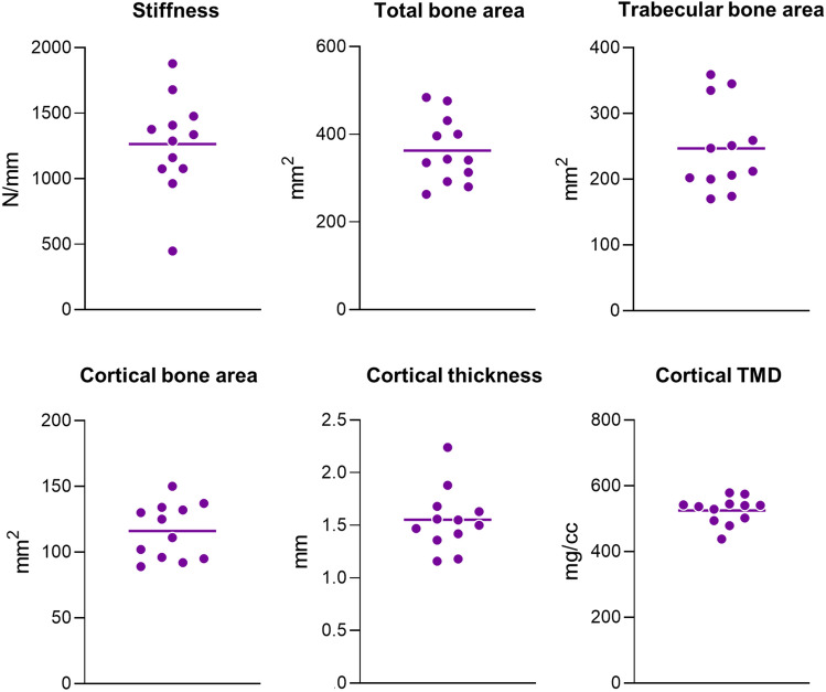 The Multifactorial Relationship Between Bone Tissue Water and Stiffness at the Proximal Femur.