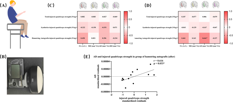 Neural structural alterations correlates of quadriceps muscle strength deficits in patients after anterior cruciate ligament reconstruction