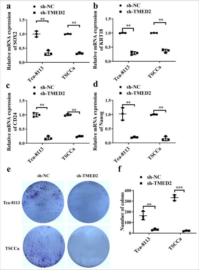 Relationship between transmembrane emp24 domain containing 2 expression and tumor stem cell characteristics in oral cancer.