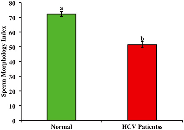 Effect of Hepatitis C Infection on Semen Parameters of Men From Rawalpindi and Islamabad, Punjab, Pakistan.