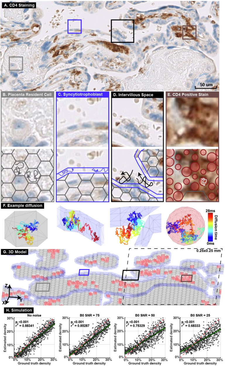 Quantitative and longitudinal assessment of human placental inflammation using diffusion basis spectrum imaging.