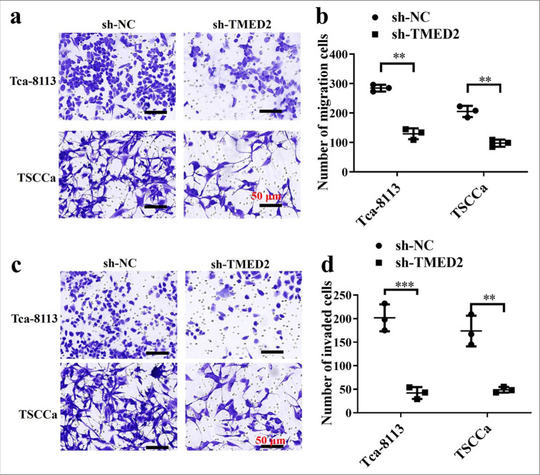 Relationship between transmembrane emp24 domain containing 2 expression and tumor stem cell characteristics in oral cancer.
