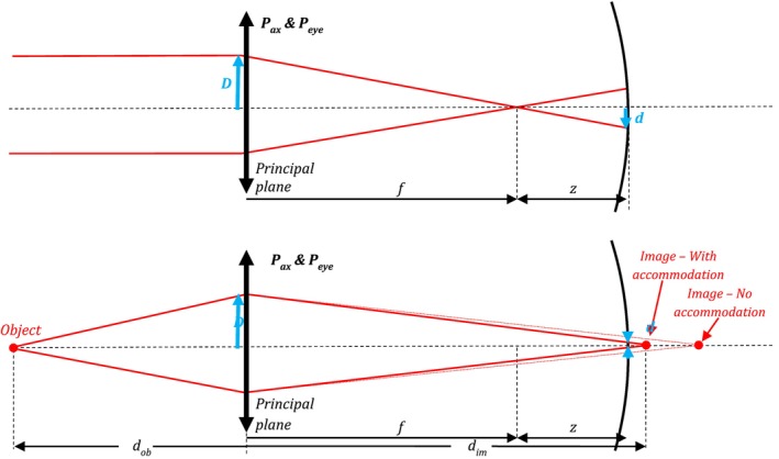 Refractive development II: Modelling normal and myopic eye growth.