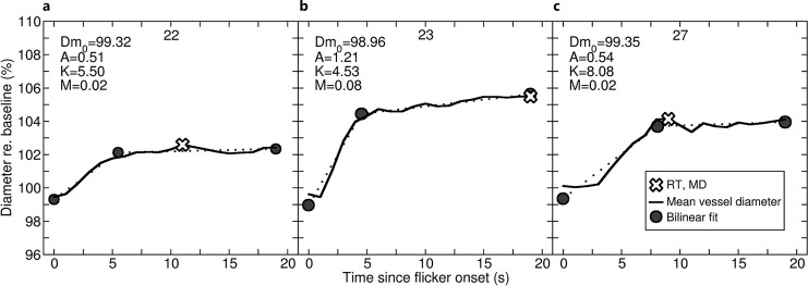 Characterising the Time Course of the Dilatory Response of Healthy Retinal Arteries during Flicker-Light Provocation.