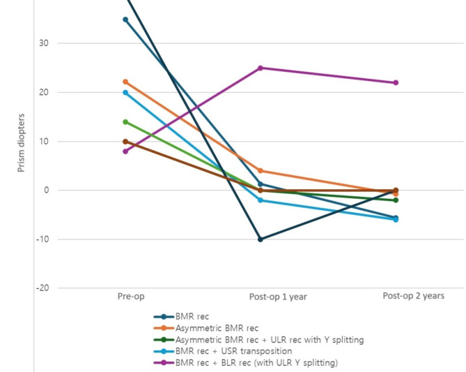 Long-term surgical outcomes of esotropic duane retraction syndrome type 1.