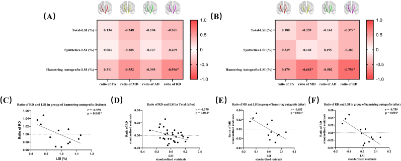 Neural structural alterations correlates of quadriceps muscle strength deficits in patients after anterior cruciate ligament reconstruction