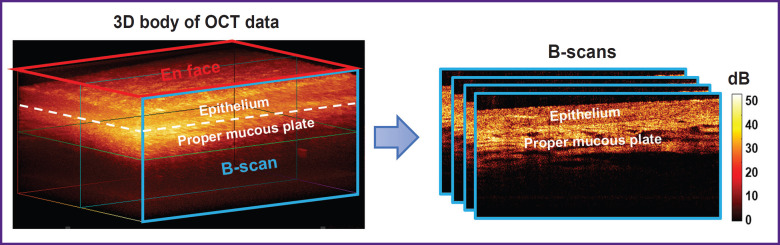 Criteria for Vaginal Atrophic Changes in Genitourinary Syndrome of Menopause Using Optical Coherence Tomography.