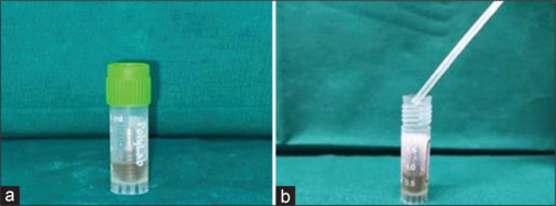 Comparative evaluation of the efficacy of 10% doxycycline gel and 1% chlorhexidine digluconate gel in the disinfection of sandblasted acid-etched titanium implant surface contaminated with <i>Porphyromonas gingivalis</i>.