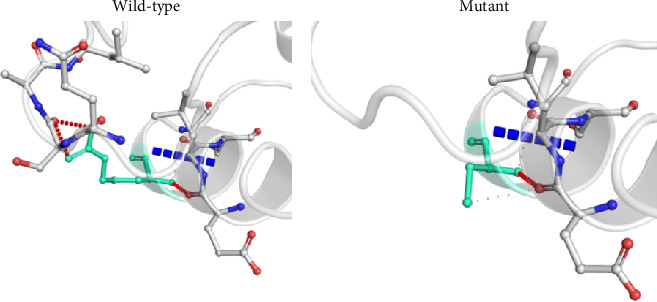Insights Into Genetic Variations of the <i>OCT1</i> Gene in Metformin Poor Responders Among Bangladeshi Type 2 Diabetic Patients.