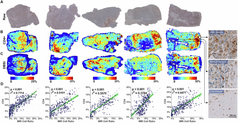Quantitative and longitudinal assessment of human placental inflammation using diffusion basis spectrum imaging.