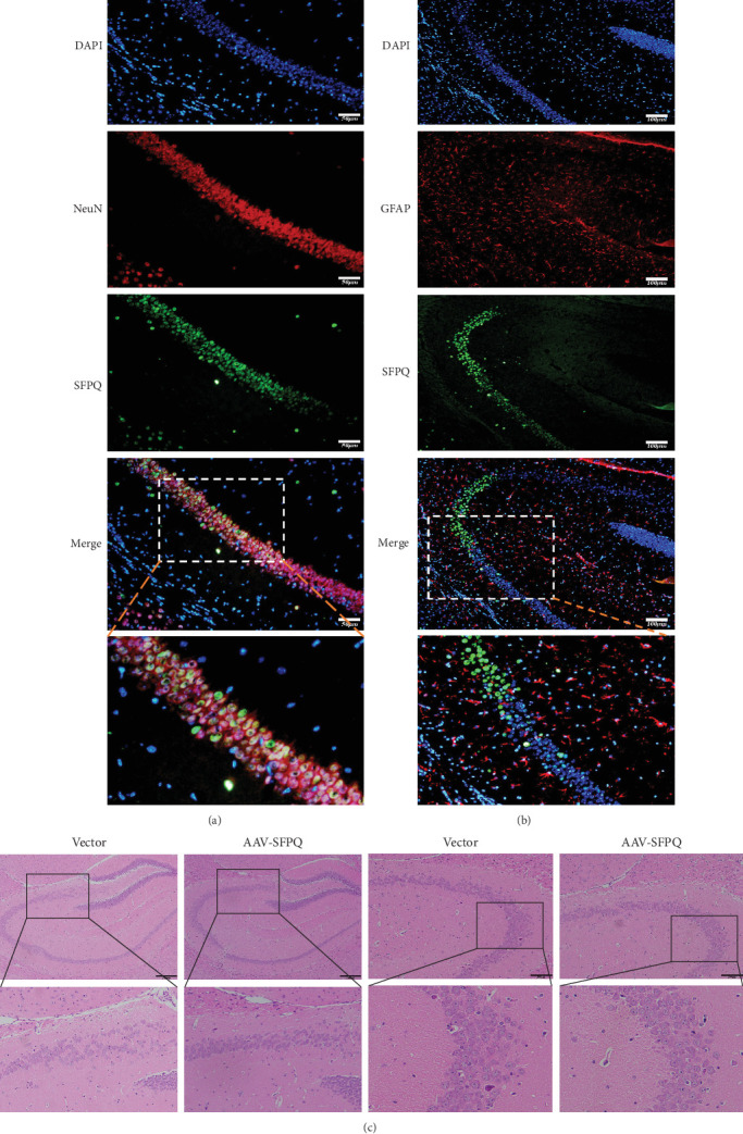 Overexpression of SFPQ Improves Cognition and Memory in AD Mice.