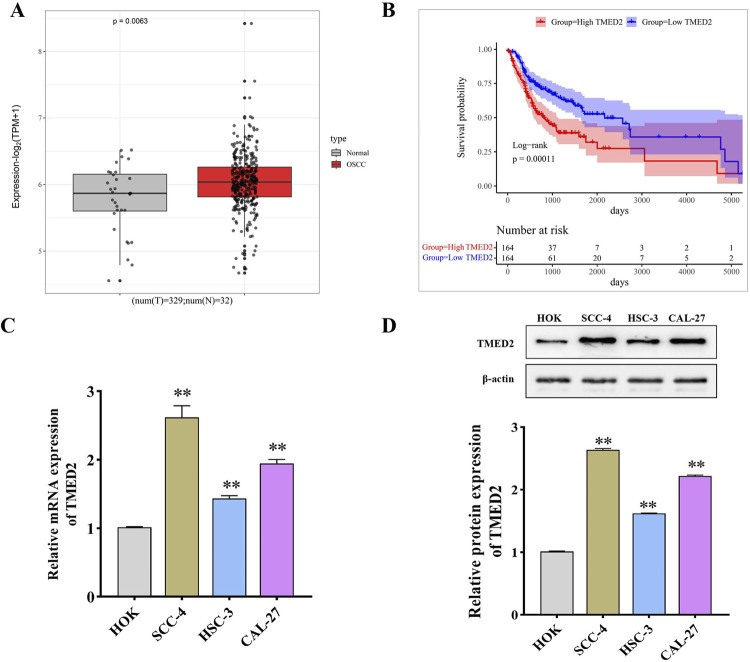 Study of the role of transmembrane emp24 domain-containing protein 2 in oral squamous cell carcinoma.