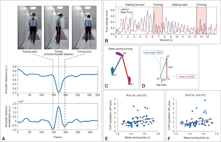Spatiotemporal Gait Parameters During Turning and Imbalance in Parkinson's Disease: Video-Based Analysis From a Single Camera.