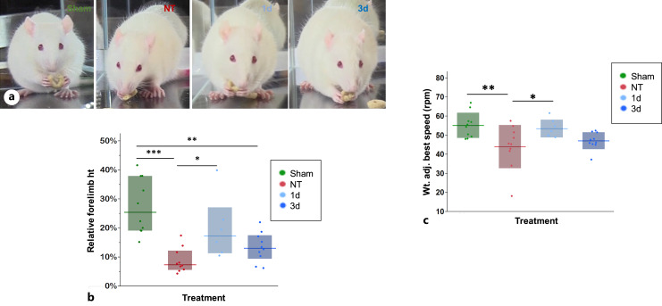 Structural and Functional Effects of C5aR1 Antagonism in a Rat Model of Neonatal Hypoxic-Ischemic Encephalopathy.