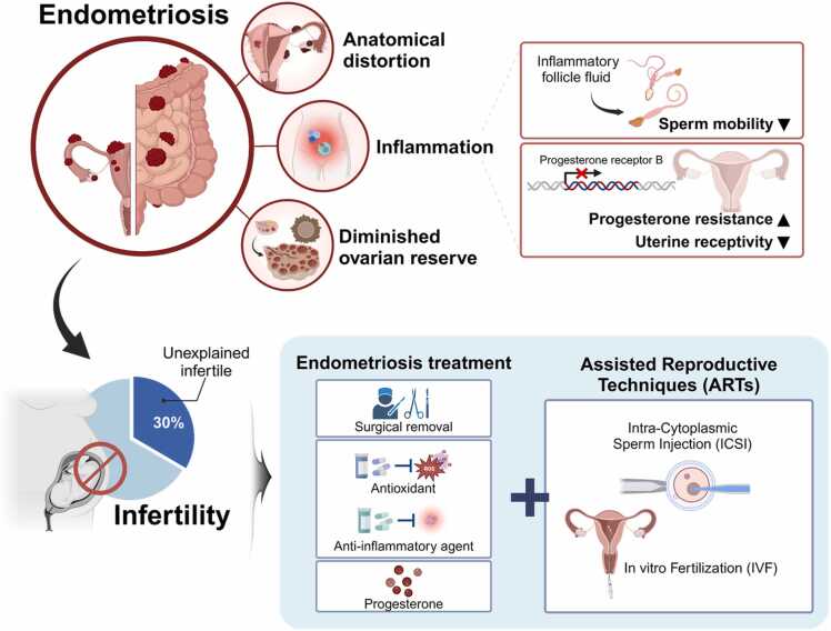 Female reproductive disease, endometriosis: From inflammation to infertility
