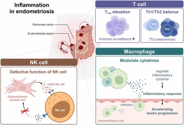 Female reproductive disease, endometriosis: From inflammation to infertility