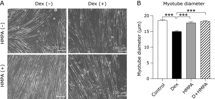 3-(4-Hydroxy-3-methoxyphenyl) propionic acid mitigates dexamethasone-induced muscle atrophy by attenuating Atrogin-1 and MuRF-1 expression in mouse C2C12 skeletal myotubes.