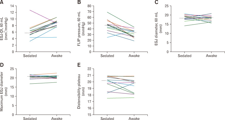 The Esophageal Response to Distension on Functional Lumen Imaging Probe Panometry Is Minimally Changed by Conscious Sedation in Healthy Asymptomatic Subjects.
