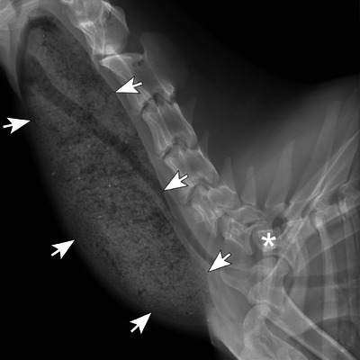 Segmental Megaesophagus Secondary to Extraluminal Esophageal Stenosis Caused by Transitional Seventh Cervical Vertebra and Supernumerary Ribs in a Goat.
