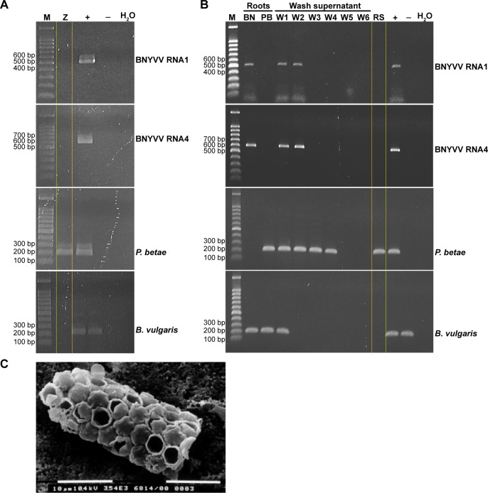 Relative frequency dynamics and loading of beet necrotic yellow vein virus genomic RNAs during the acquisition by its vector <i>Polymyxa betae</i>.