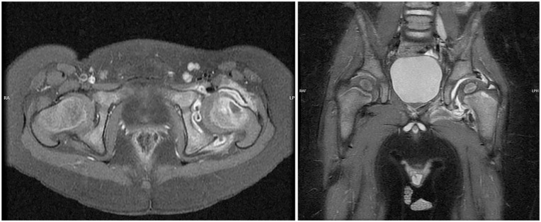 Diagnosis and management of septic arthritis: A current concepts review.