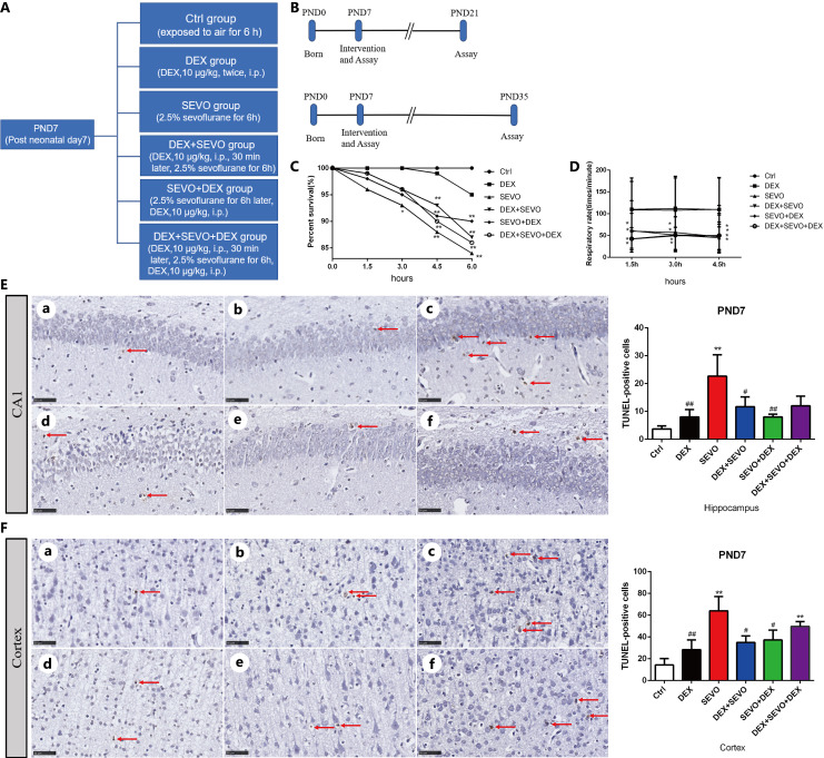 Dexmedetomidine Alleviates the Long-Term Neurodevelopmental Toxicity Induced by Sevoflurane in the Developing Brain.