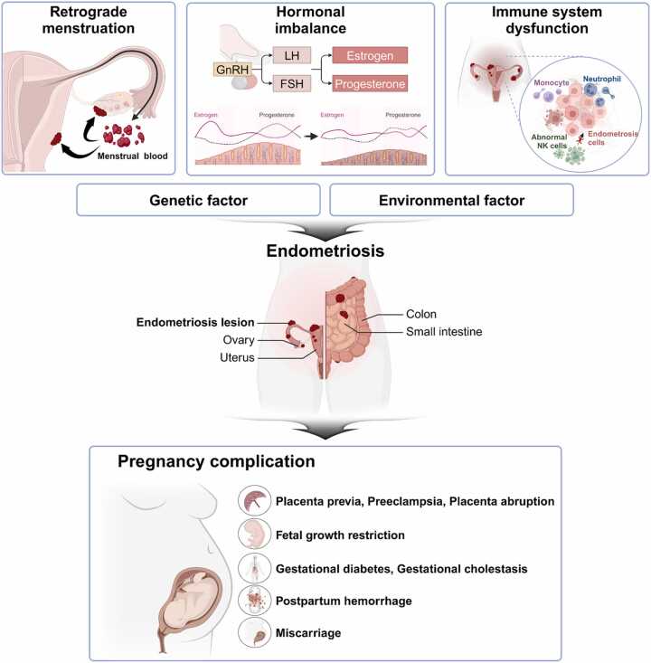 Female reproductive disease, endometriosis: From inflammation to infertility